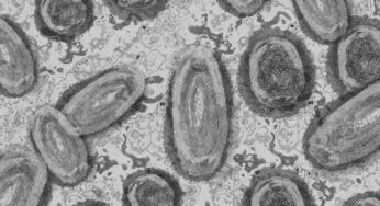 Neues Virus in Frankreich: Bis zu 50 Prozent der Infizierten sterben